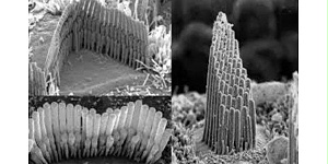 20岁的年龄，60岁的听力？说说怎么照顾好我们的耳朵。