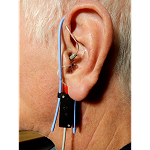 什么是真耳分析（测试）？