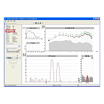 如何看懂耳声发射检测报告的关键参数？