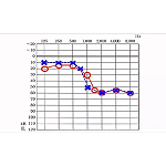 什么是听阈和听域？