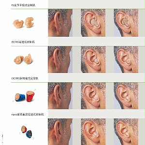 这么多助听器，应该如何选择？