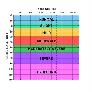 什么是功能增益？