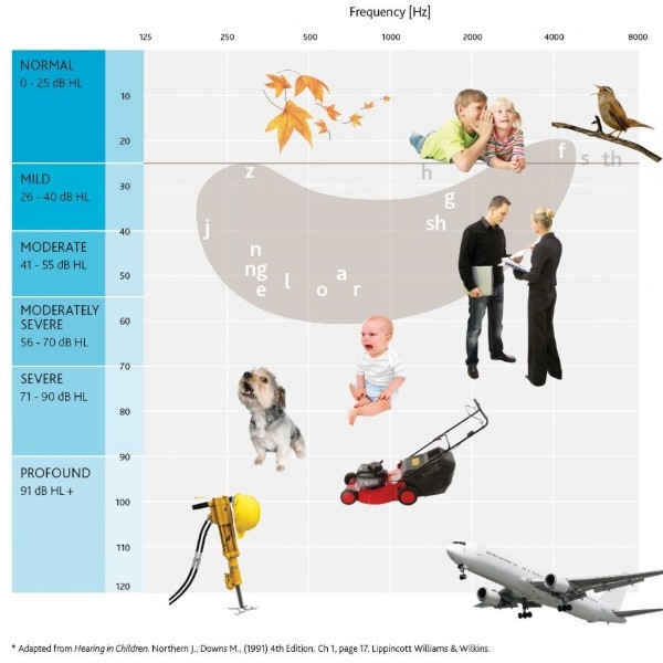 Degrees-of-hearing-loss.jpg