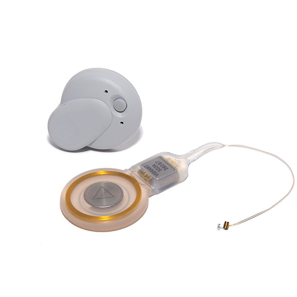 植入中耳(Middle Ear Transducer)是什么？