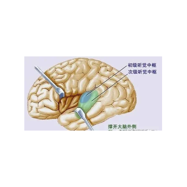 听觉有几个层次？