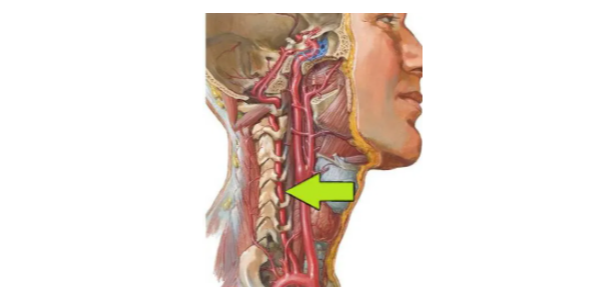 颈性眩晕综合征从解剖到治疗，一网打尽