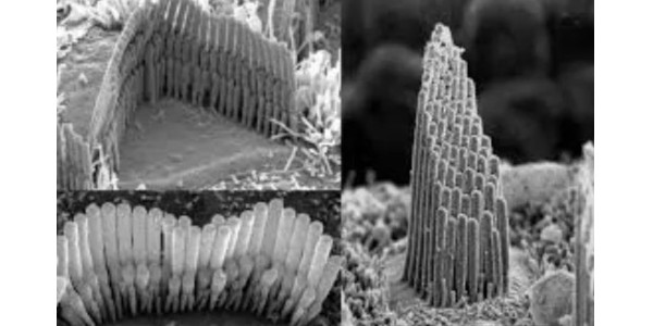 20岁的年龄，60岁的听力？说说怎么照顾好我们的耳朵。