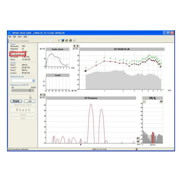 如何看懂耳声发射检测报告的关键参数？
