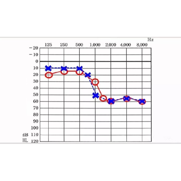 什么是听阈和听域？