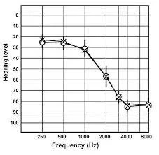 什么是移频助听技术？