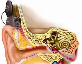 什么是导入电刺激